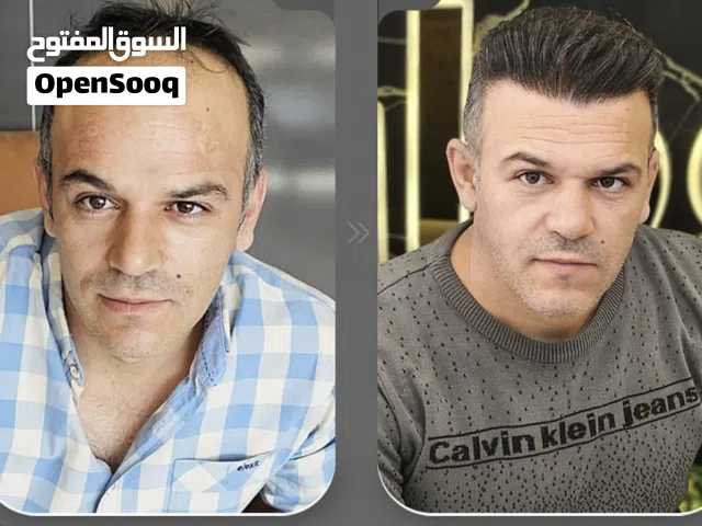 زراعة شعر وحواجب طبيعية
