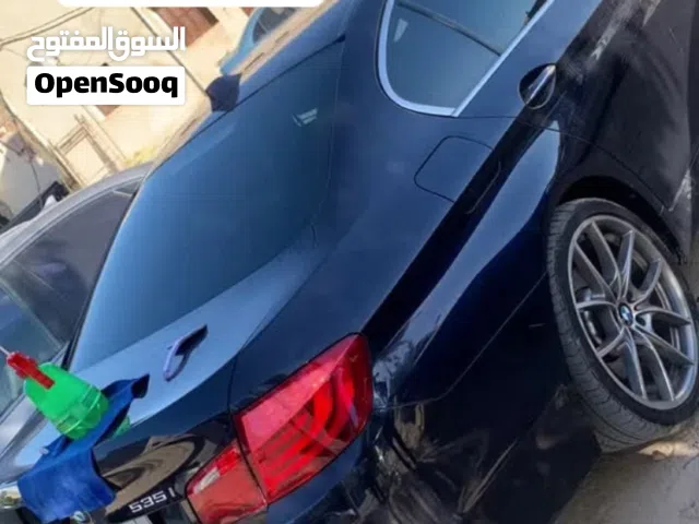 فني تركيب سلفر و تنظيف فنارات نجيك لا عندك منضومة ليز كربون اي شي كماليا كلمني