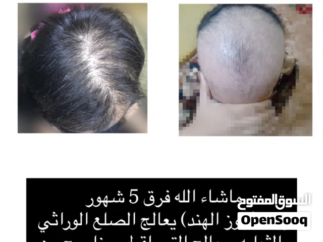 زيت شعر عجايب