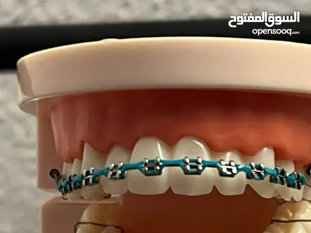 تقويم اسنان زينه وارد من الكويت