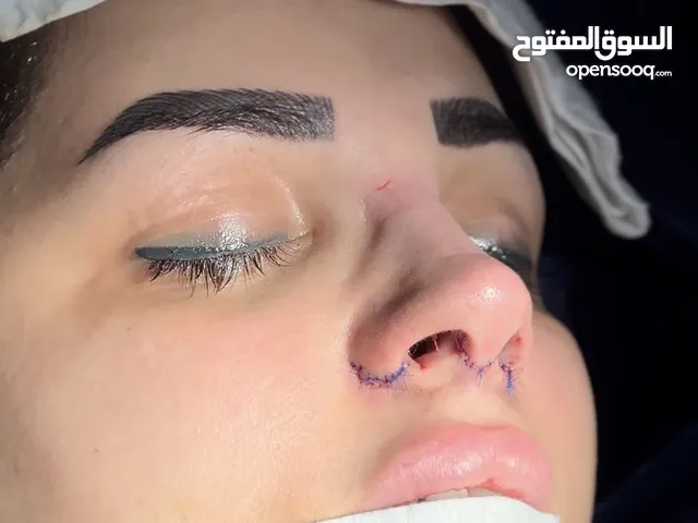 تجمیل الأنف