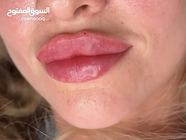 خدمات تجميل(حقن)