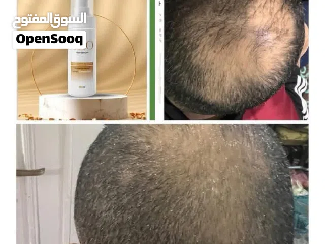GRO Hair serum My Lifestyle Skin and "امتلك شعراً قوياً وكثيفاً وشاهد النتائج خلاHair Care Products