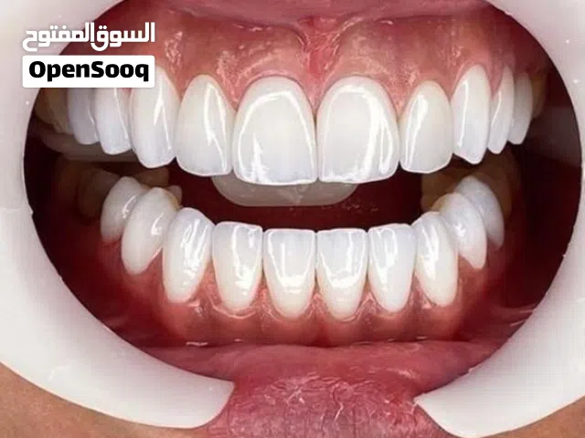 إبتسامة هوليوود الثابتة