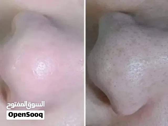 جهاز إزالة الرؤوس السوداء جديد استخدام سهل