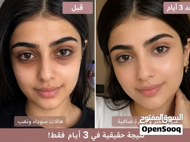 إذا عندكم هالات سودا ومضايقتكم كل يوم ، الحل في كريم الهالات السوداء هتخلصي من الهالات في 3 أيام فقط