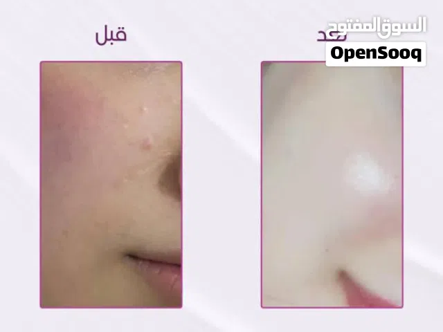 روتين العناية بالبشرة كوين سنتر