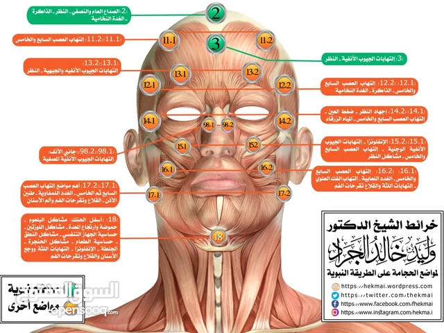 الحجامة العلاجية والوقائية