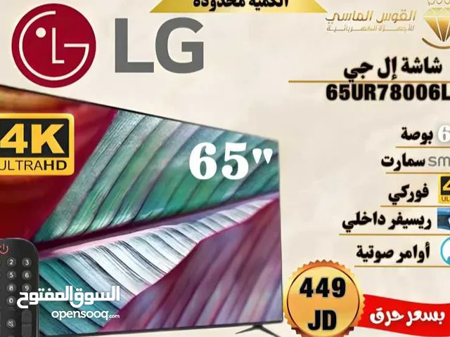 شاشه ال جي 65 بوصه سمارت احدث اصدار سعر حرق لمده 3 ايام