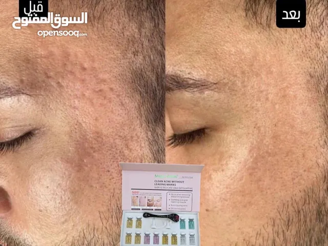 امبولات ماركه الكوري الأصلي مجرب مضمون 100%
