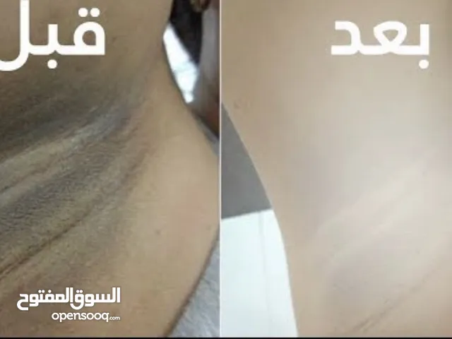كريم تبيض فوري