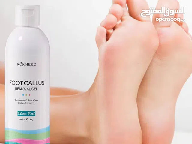 كالوس القدم