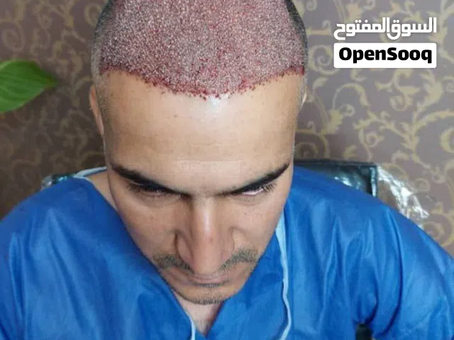 زراعة الشعر في إيران، مشهد، رحلات طبية مع الحج والعمرة بأقل تكلفة وأفضل الأطباء