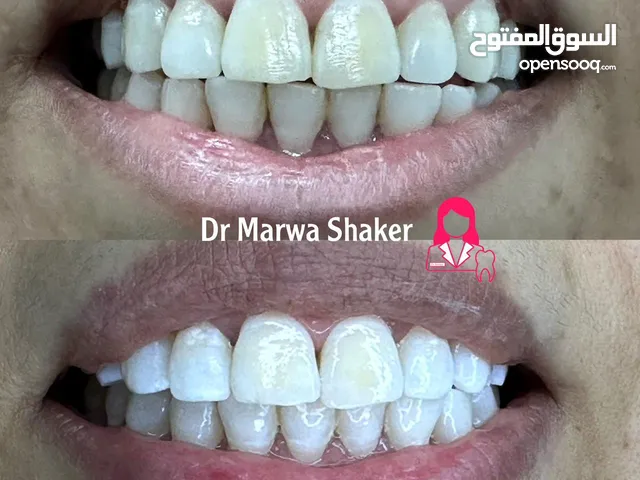 عيادة دكتورة مروة شاكر للأسنان