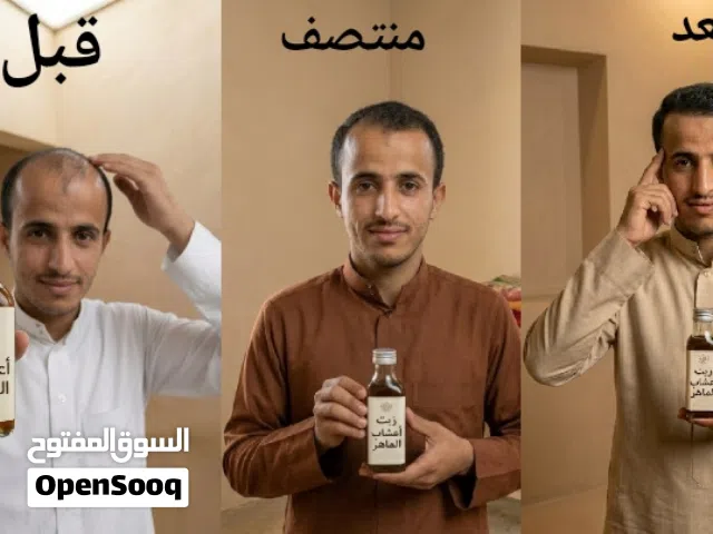 زيت أعشاب الماهر لعلاج الصلع ونمو الشعر