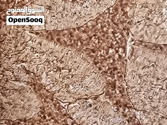 مطلوب عجال و عجلات عمانيات او مال صلالة العمر من 5 الى 8 شهور .