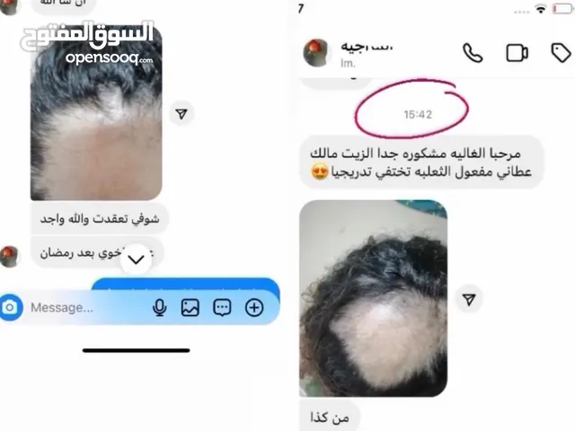 زيت علاج الثعلبة وتساقط الشعر — نتائج مضمونة