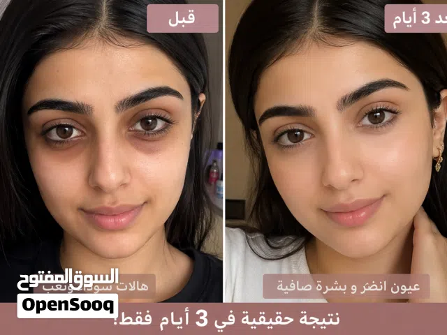 كريم شد وتفتيح تحت العين في 3 أيام فقط