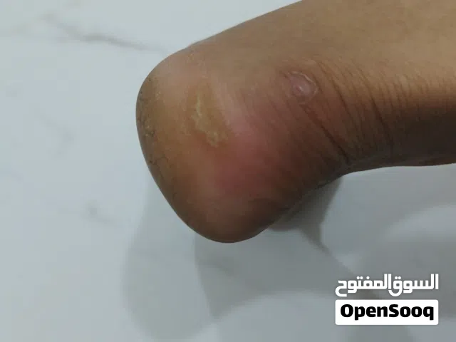 جهاز إزالة الجلد الميت وتشقق القدمين  خلي كعبك ناعم مثل الحرير من أول استخدام