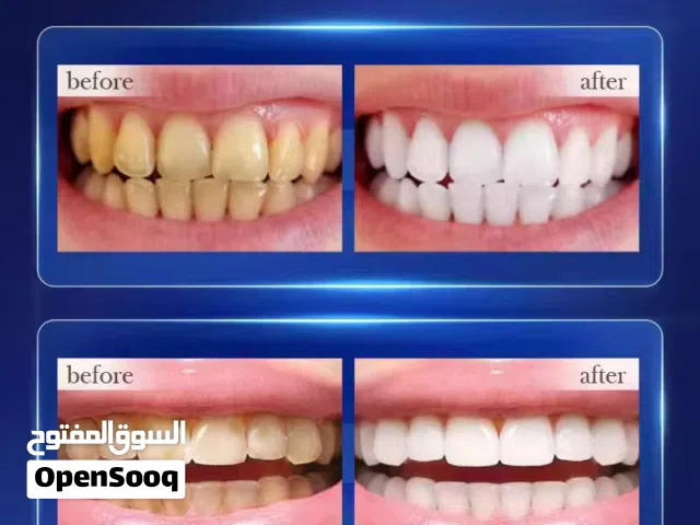 معجون أسنان ROREC SADOER الاصلي