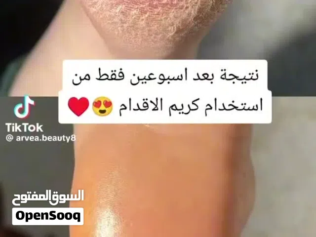 كريم الأقدام