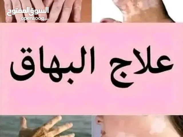 كل ما يخص البهاق