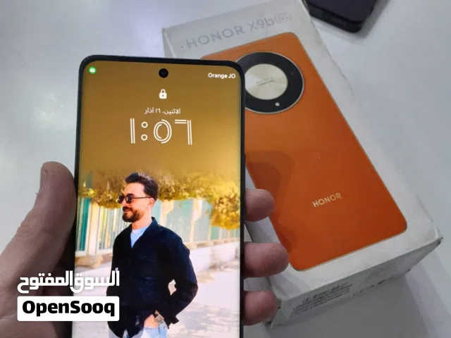 هونر x9b 5g شبه وكاله