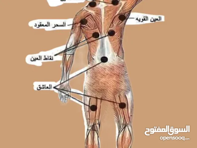 حجامة   8كاسات