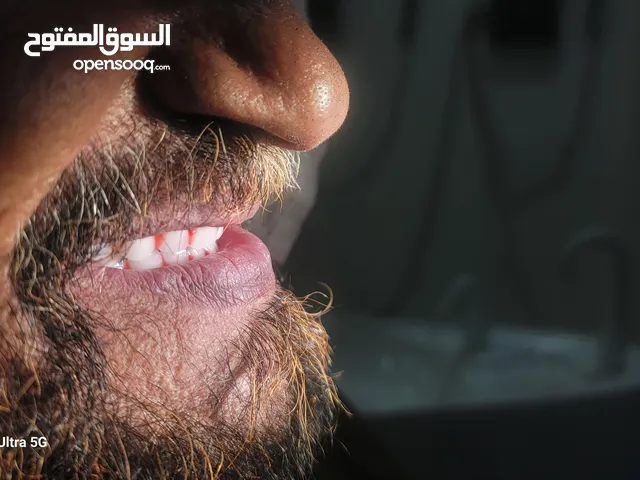 علاج للاسنان بأسعار رمزية جداً