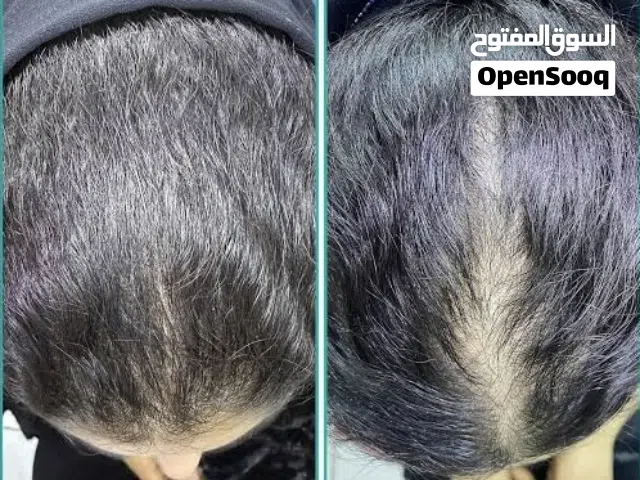 زيت شعر العضوي