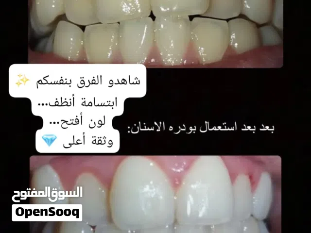 افضل بودرة لتنظيف وتبييض الاسنان تجارب الزبائن دليل على جودة المنتج