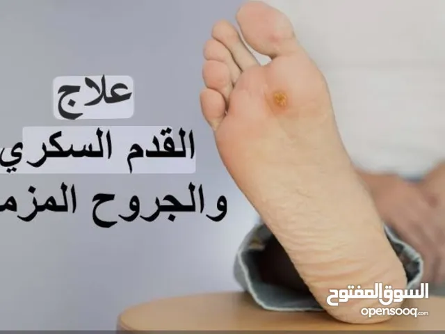 علاج القدم السكرية والجروح وعمل غيارات بالمنزل على الجروح و العنايه بالفتحات الجانبية stoma care