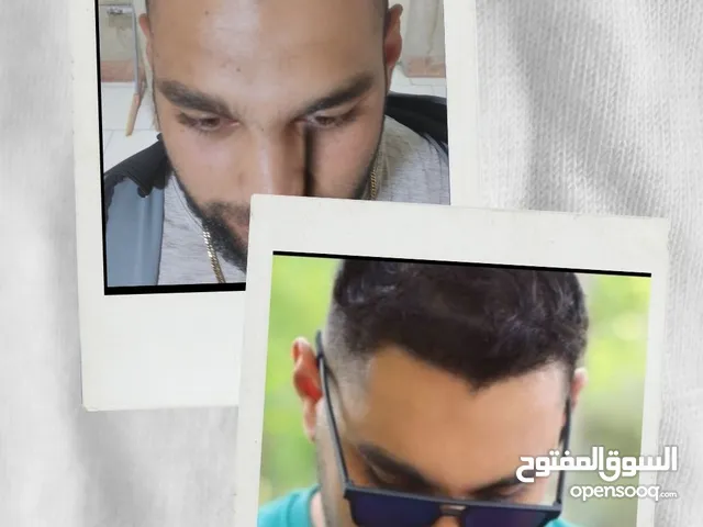 زراعة شعر طبيعية ومضمونة في مشهد – إيران خبرة طبية – سعر مناسب – نتائج مبهرة