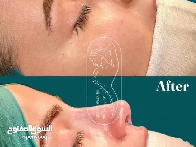Cosmetic surgery at half the price