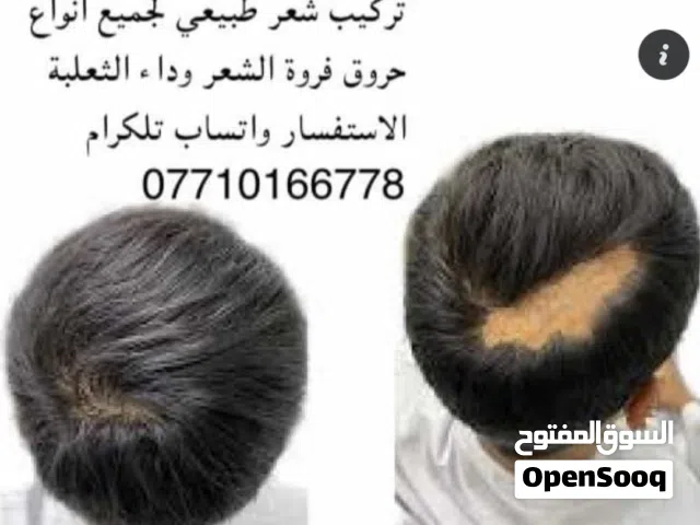 كل مايخص تركيب الشعر