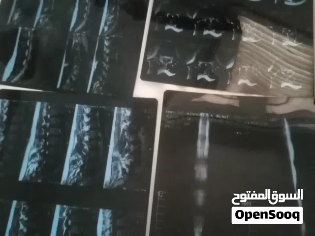 افلام اشعه مستعمله
