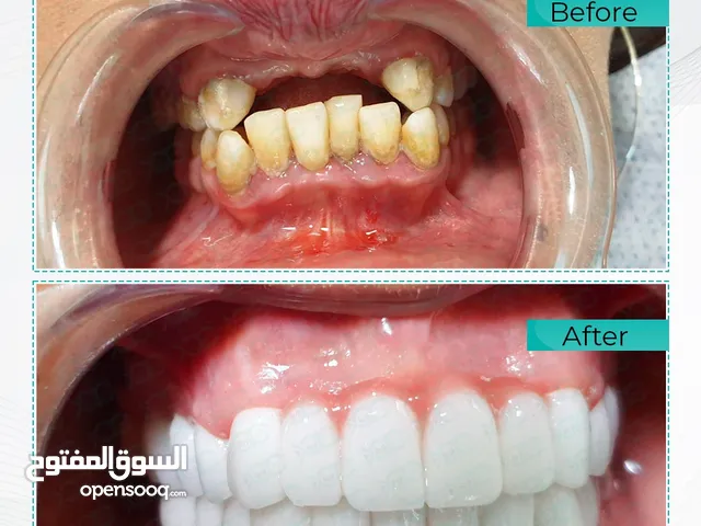 عيادة الياسري لطب و تجميل الفم و الاسنان