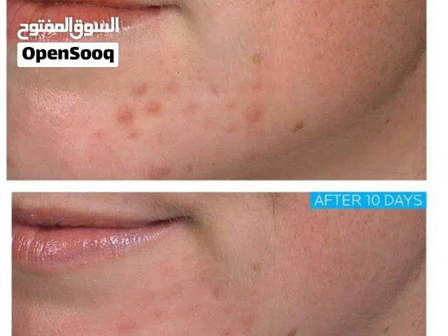 La Roche-Posay Effaclar Duo(+) Soin anti-imperfections & anti-marques علاج للرؤوس والحبوب وآثارها