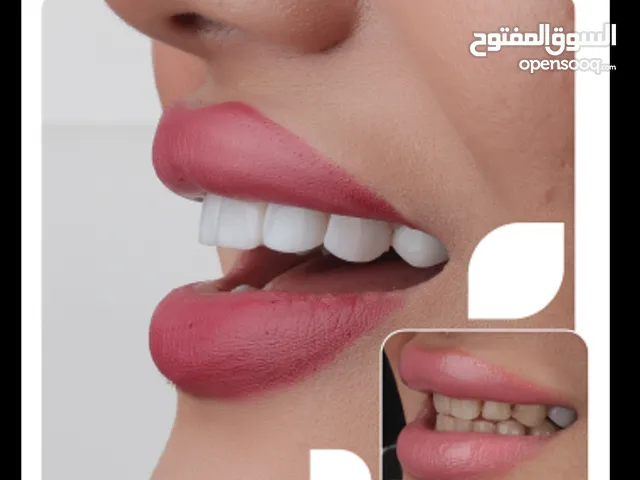 تجمیل أسنان تعدیل البسمه