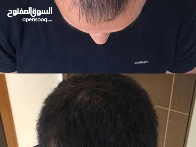 عرض لتكثيف وتطويل ومنع تساقط الشعر يتكون زيت اكليل الجبل والنعناع للشعر من براند ميلي +ديرمارول