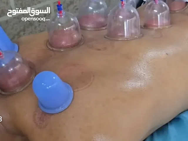 حجامه رطبه وحجامه جافه