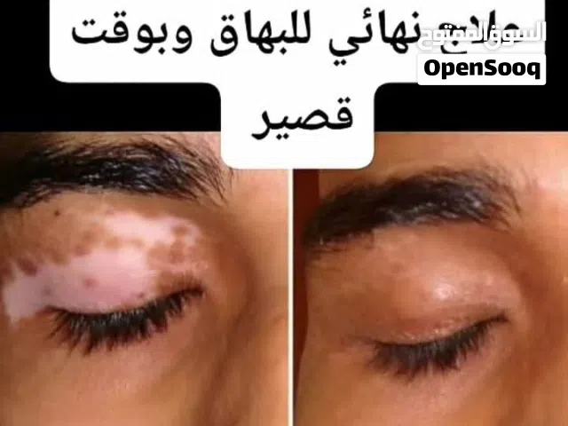 لتوحيد اللون