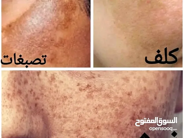 مشاكل البشرة.لدينا لك حلول مجربة