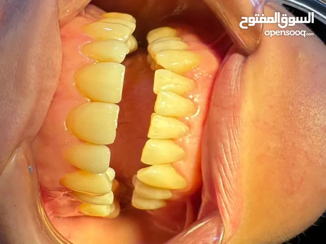 تعلن عيادات الكوثر و الكناري لطب وتجميل الاسنان عروض