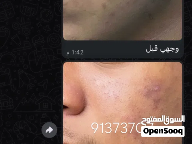 خلطات تفتيح لرجال وتناسب العساكر مضمونة
