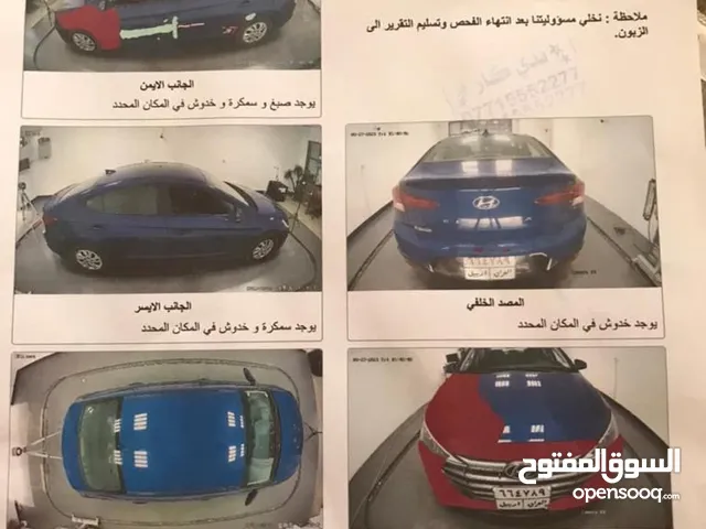 الانترا كندي