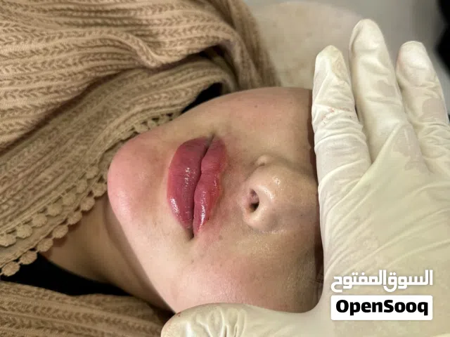 Aesthetic Specialist – Botox, Filler & Eyebrow – Cooperation with Clinic