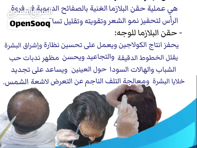 حقن البلازماء للشعر والبشرة