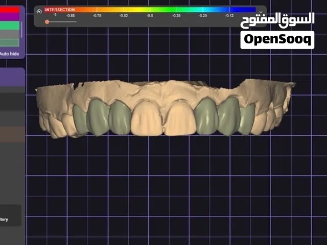 مصمم أسنان CAD/CAM – تصميم تيجان وزركون وابتسامة رقمية
