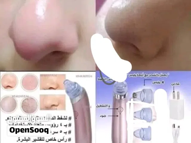 جهاز شفط الدهون...............